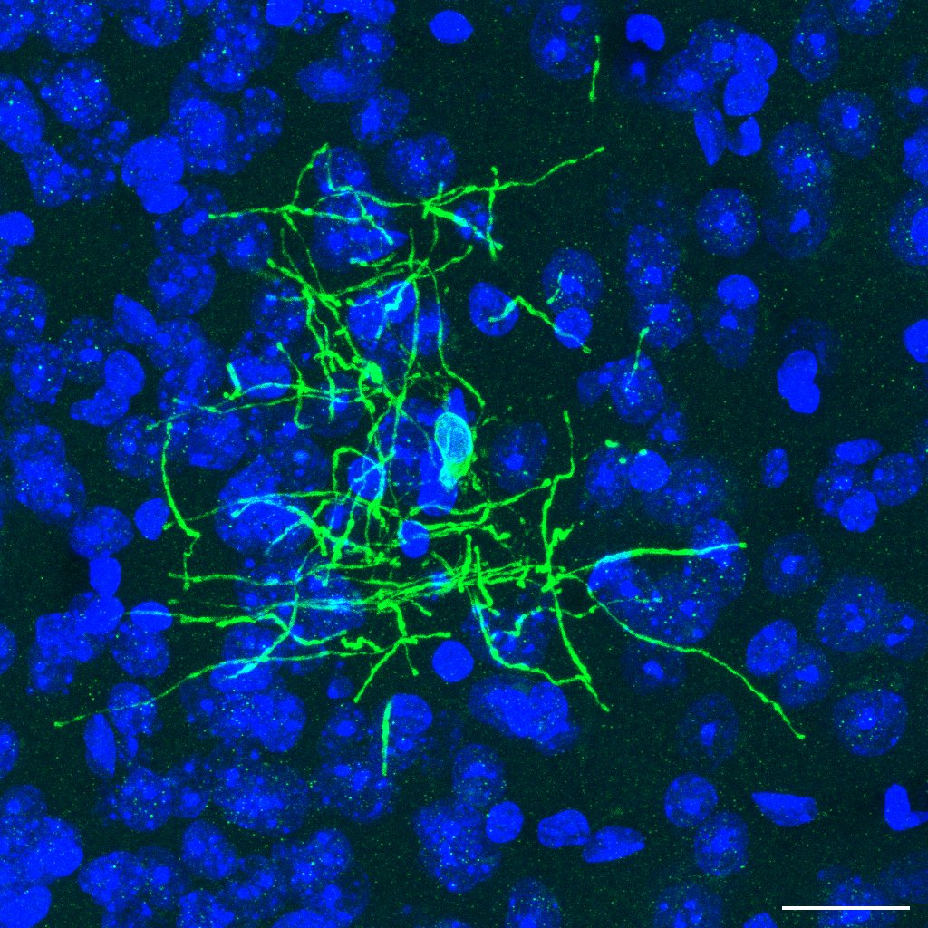 New NIH/NIA R01 Award Alert!